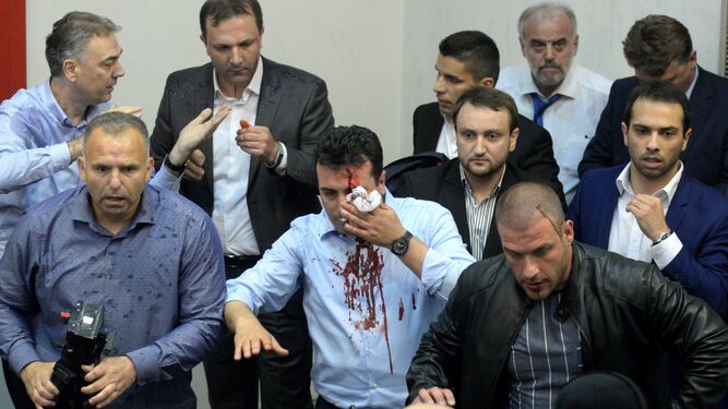 El líder de la SDMS, Zoran Zaev, sangrando tras ser agredido ayer.