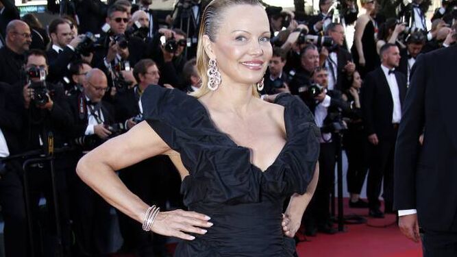 Pamela Anderson, la última víctima de la cirugía