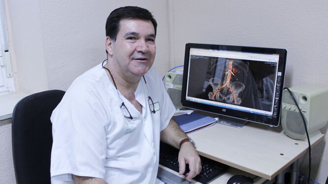 Rodríguez Piñero muestra la imagen de un escáner donde se visualiza una endoprótesis implantada en un paciente.