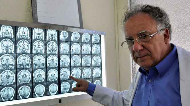 Guillermo Izquierdo, especialista en Neurología y coordinador del II Foro Regional de Esclerosis Múltiple.