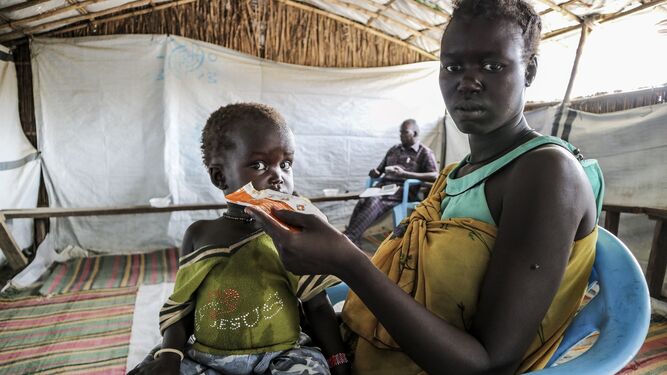 Un niño desnutrido con su madre en Sudán del Sur.