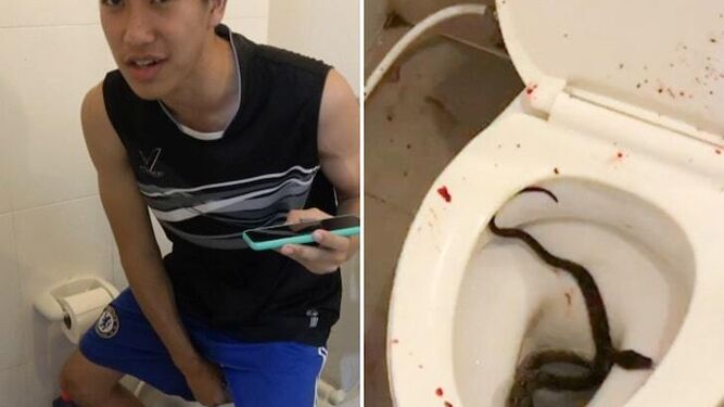 Una serpiente pitón muerde a un joven en el pene mientras estaba en el WC