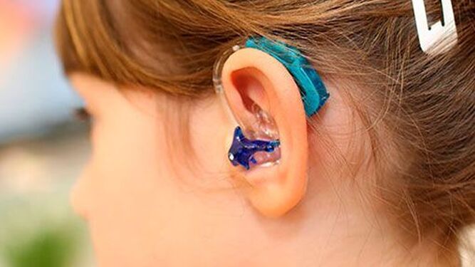 Dos otorrinolaringólogas españolas devuelven la audición a una niña gracias a una técnica pionera