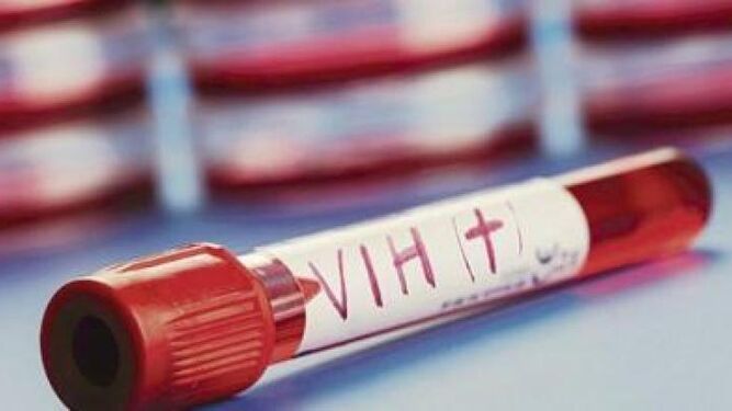 Vial de sangre que es VIH positivo