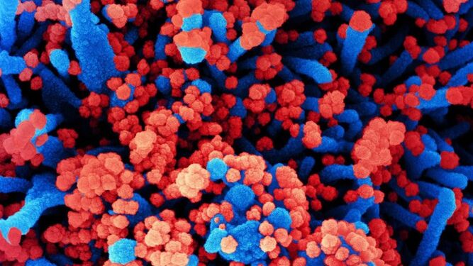 Imagen cedida por el CSIC de una micrografía electrónica de barrido de células humanas (azul) infectadas con SARS-CoV-2 (rojo).