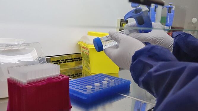 Test de la viruela del mono en un laboratorio, en una imagen reciente.