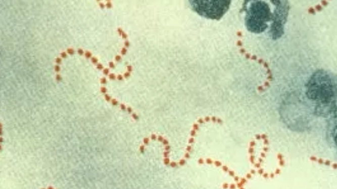Bacteria del estreptococo A