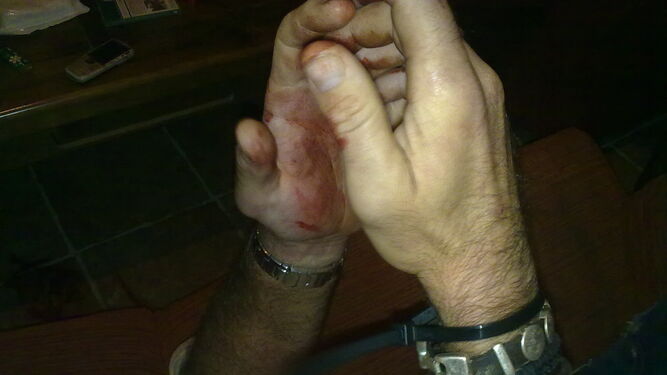 Las manos de un hombre torturado por sicarios en una operación en Cádiz.
